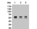 Lyn Polyclonal Antibody