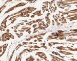 RGMA Antibody in Immunohistochemistry (Paraffin) (IHC (P))
