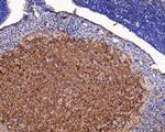ASIC4 Polyclonal Antibody
