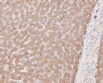 PRKCSH Antibody in Immunohistochemistry (Paraffin) (IHC (P))