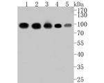 PRKCSH Antibody in Western Blot (WB)