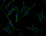 PPP1R9A Polyclonal Antibody