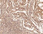 ZFHX3 Polyclonal Antibody