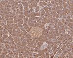 Trypsin 2 Antibody in Immunohistochemistry (Paraffin) (IHC (P))
