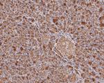 Trypsin 2 Antibody in Immunohistochemistry (Paraffin) (IHC (P))