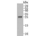 Trypsin 2 Antibody in Western Blot (WB)