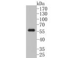 CTNNA3 Antibody in Western Blot (WB)