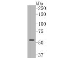 CTNNA3 Antibody in Western Blot (WB)