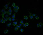 TSC1 Polyclonal Antibody