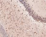KCNK6 Antibody in Immunohistochemistry (Paraffin) (IHC (P))