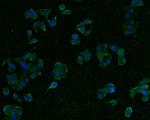 Presenilin 1 Polyclonal Antibody