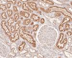 SKI Antibody in Immunohistochemistry (Paraffin) (IHC (P))