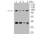 STRAP Antibody in Western Blot (WB)