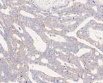 UCRC Polyclonal Antibody