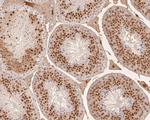 DRAP1 Antibody in Immunohistochemistry (Paraffin) (IHC (P))