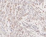 DRAP1 Polyclonal Antibody