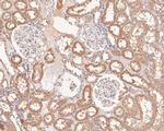 UBE2D1 Antibody in Immunohistochemistry (Paraffin) (IHC (P))