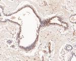 UBE2D1 Antibody in Immunohistochemistry (Paraffin) (IHC (P))