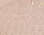 UBE2D3 Antibody in Immunohistochemistry (Paraffin) (IHC (P))