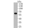 RGS6 Antibody in Western Blot (WB)