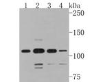 SMG5 Polyclonal Antibody