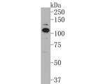 SMG5 Antibody in Western Blot (WB)