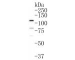 SMG5 Antibody in Western Blot (WB)