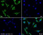 TTK Polyclonal Antibody