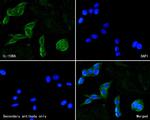 IL10RA Polyclonal Antibody