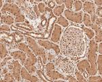 SNRPD3 Antibody in Immunohistochemistry (Paraffin) (IHC (P))