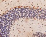 EEF1G Antibody in Immunohistochemistry (Paraffin) (IHC (P))