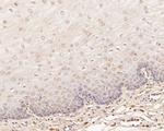 EEF1G Antibody in Immunohistochemistry (Paraffin) (IHC (P))