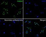 FARS2 Polyclonal Antibody
