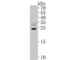 TIFY11A Polyclonal Antibody