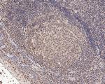 LEF1 Antibody in Immunohistochemistry (Paraffin) (IHC (P))