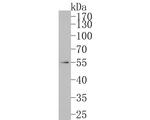FAM13C Antibody in Western Blot (WB)