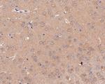 GABRB2 Polyclonal Antibody