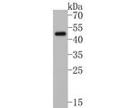 CD123 Antibody in Western Blot (WB)