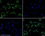 GAB2 Polyclonal Antibody