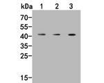 PRR5 Polyclonal Antibody