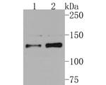 MYT1 Antibody in Western Blot (WB)