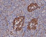 ATGL Polyclonal Antibody