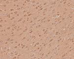 PLCB1 Antibody in Immunohistochemistry (Paraffin) (IHC (P))