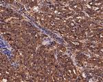 IL5RA Antibody in Immunohistochemistry (Paraffin) (IHC (P))