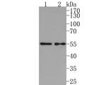 IL5RA Antibody in Western Blot (WB)