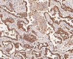 AMHR2 Polyclonal Antibody