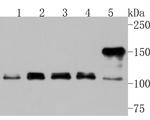 ARHGEF18 Antibody in Western Blot (WB)