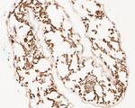 FAB1A Polyclonal Antibody