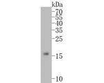 Cardiac Troponin C Antibody in Western Blot (WB)