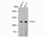 TRPM2 Polyclonal Antibody